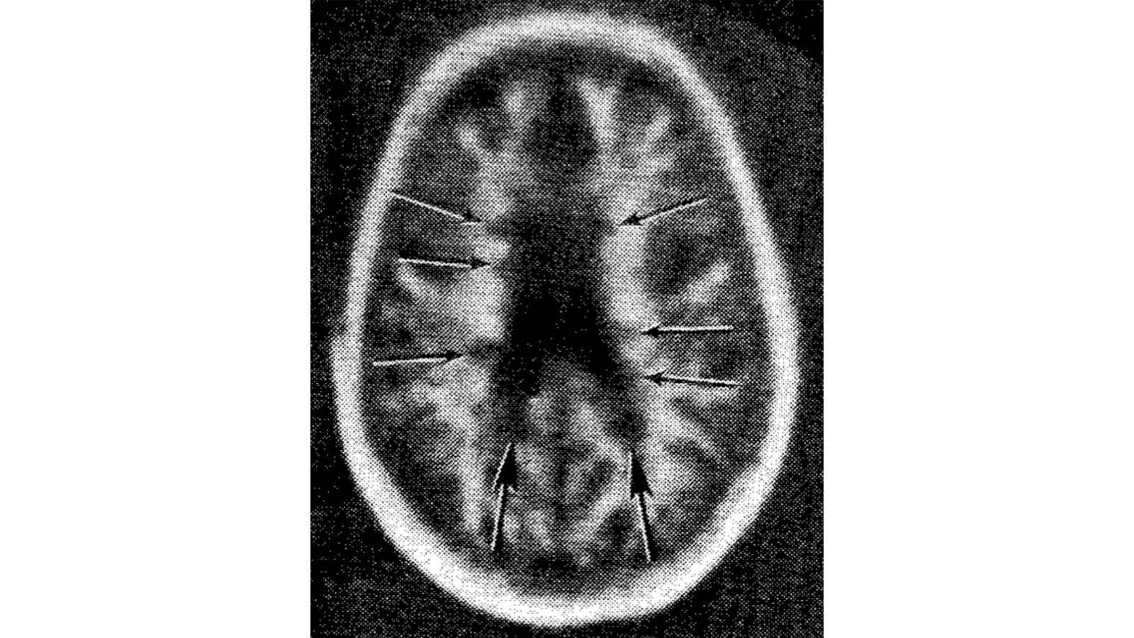 White Spots for Sale A higher seminar on “sick images” Kungl